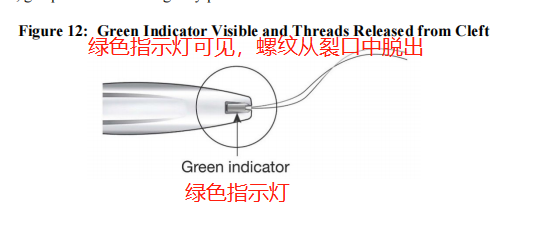 宫内节育器Liletta(图13)