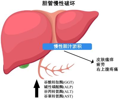 慢性胆汁淤积.jpg